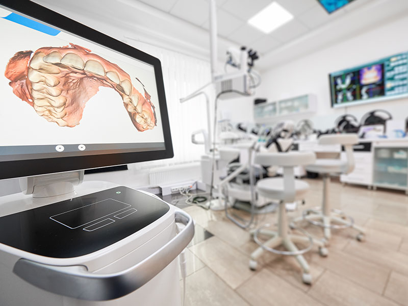 Granger Dentistry | Inlays & Onlays, Teeth Whitening and Laser Dentistry